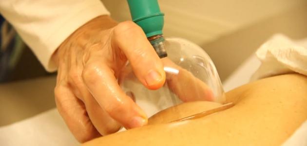 أفضل حجام بالرياض أبوياسين 0535525019|حجامة بالرياض|حجام في الرياض|حجام منزلي