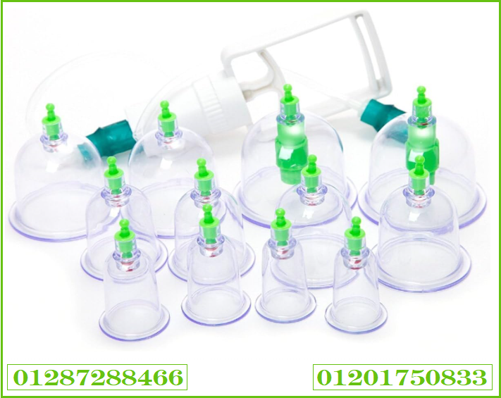 حجامة إسلامية طبية لامتصاص السموم