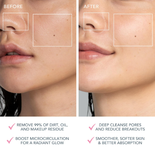 جهاز تنظيف الوجه فوريو لونا مينى فرشاة تنظيف