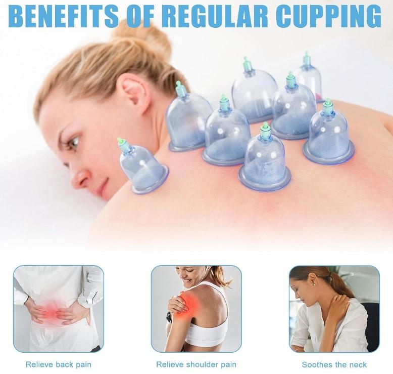 حجامة إسلامية طبية - 12 قطعة لامتصاص السموم