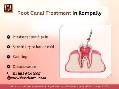 Root Canal Treatment in Kompally – FMS Dental