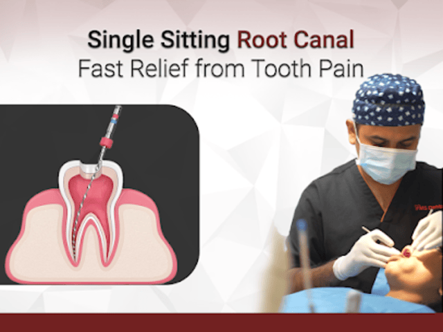 Single Sitting Root Canal Treatment in Madinaguda – FMS Dental